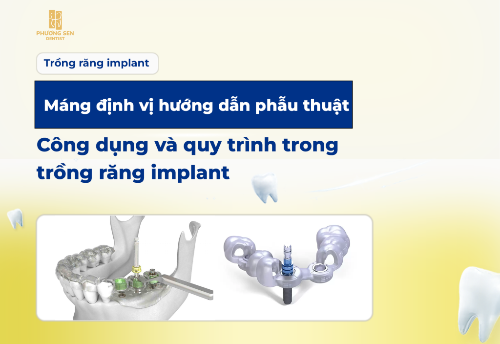 mang-dinh-vi-huong-dan